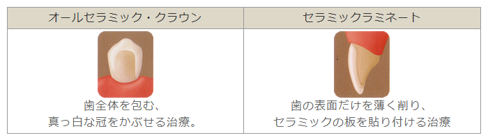 オールセラミック治療について